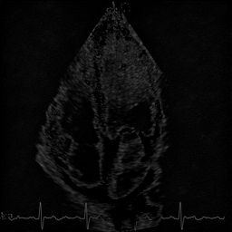 Nuclear Diffusion haze